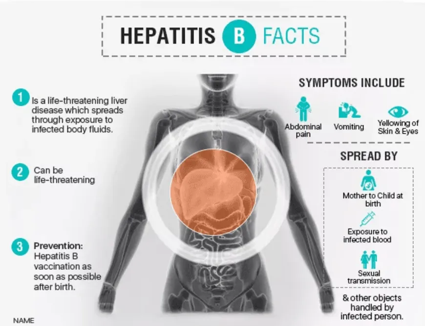 Hepatitis B facts