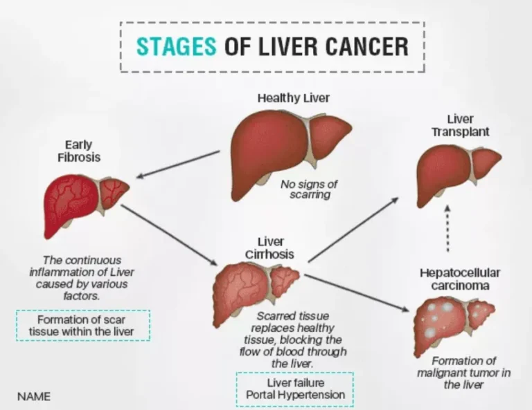 Multimodal Treatment for Liver Cancers: Advanced Options for Better Outcomes